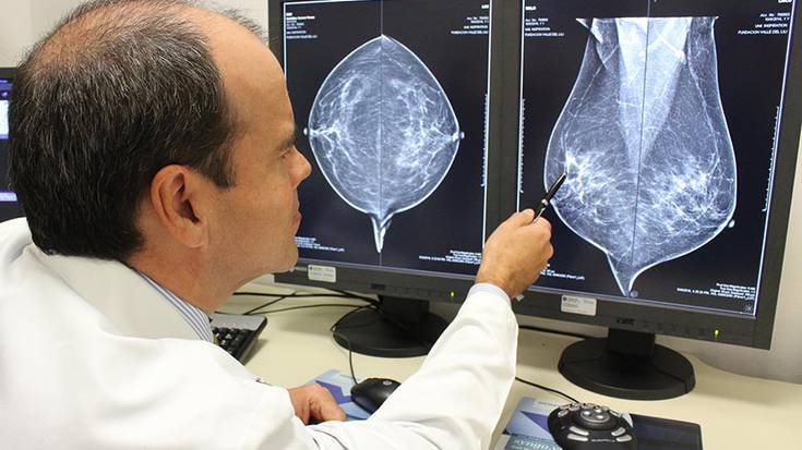 Arratsaldez ere eginen dituzte mamografiak ospitale gunean