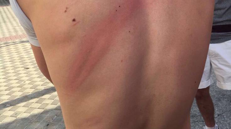 Espainiako Poliziak hainbat gazte zauritu ditu Mendillorriko Gazte Eguneko kalejiran